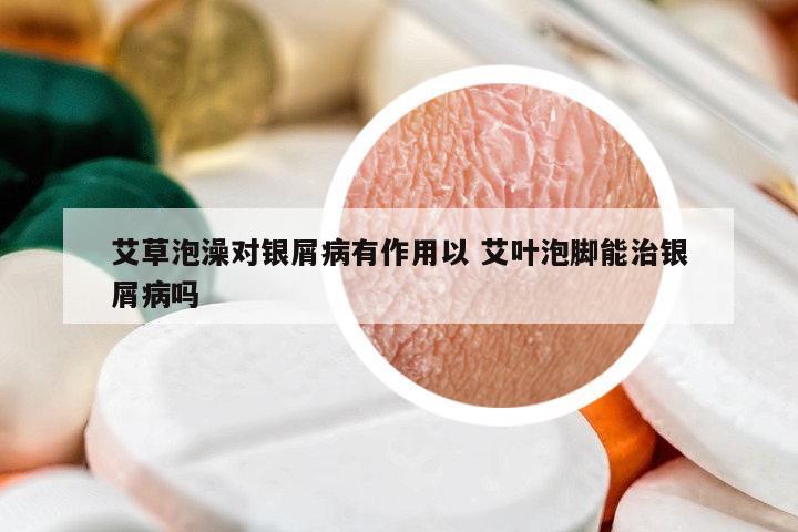艾草泡澡對銀屑病有作用以 艾葉泡腳能治銀屑病嗎