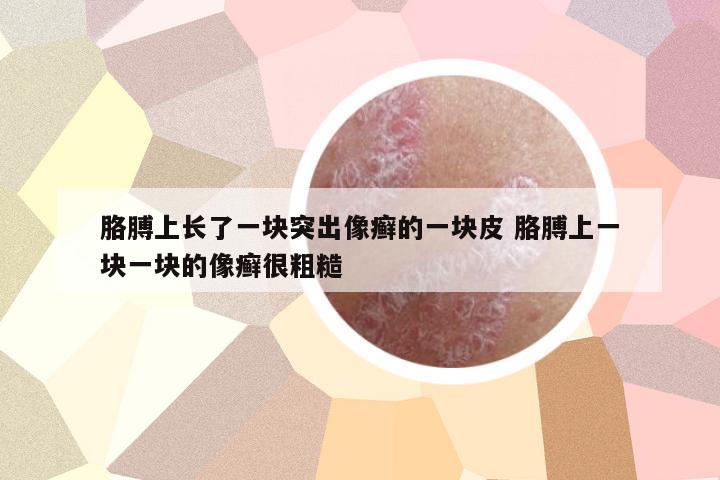 胳膊上長(zhǎng)了一塊突出像癬的一塊皮 胳膊上一塊一塊的像癬很粗糙