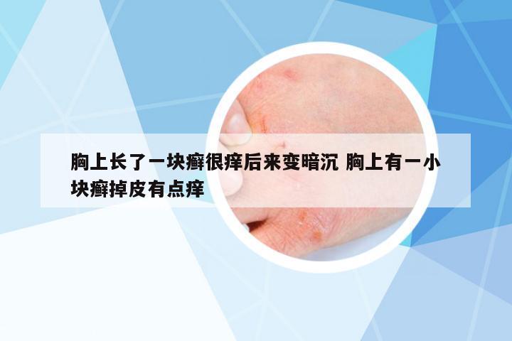 胸上長了一塊癬很癢后來變暗沉 胸上有一小塊癬掉皮有點癢