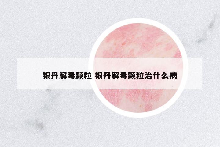 銀丹解毒顆粒 銀丹解毒顆粒治什么病