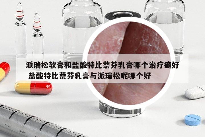 派瑞松軟膏和鹽酸特比萘芬乳膏哪個治療癬好 鹽酸特比萘芬乳膏與派瑞松呢哪個好