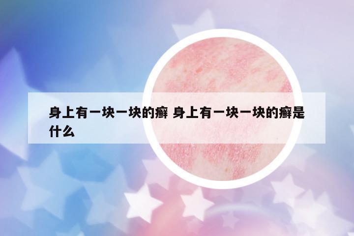 身上有一塊一塊的癬 身上有一塊一塊的癬是什么