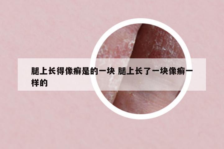腿上長得像癬是的一塊 腿上長了一塊像癬一樣的