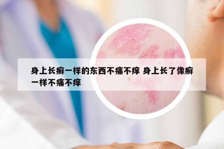 身上長(zhǎng)癬一樣的東西不痛不癢 身上長(zhǎng)了像癬一樣不痛不癢