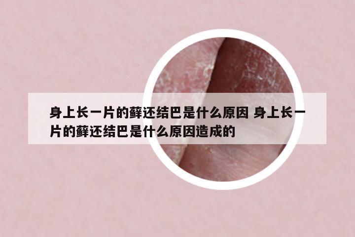身上長(zhǎng)一片的蘚還結(jié)巴是什么原因 身上長(zhǎng)一片的蘚還結(jié)巴是什么原因造成的