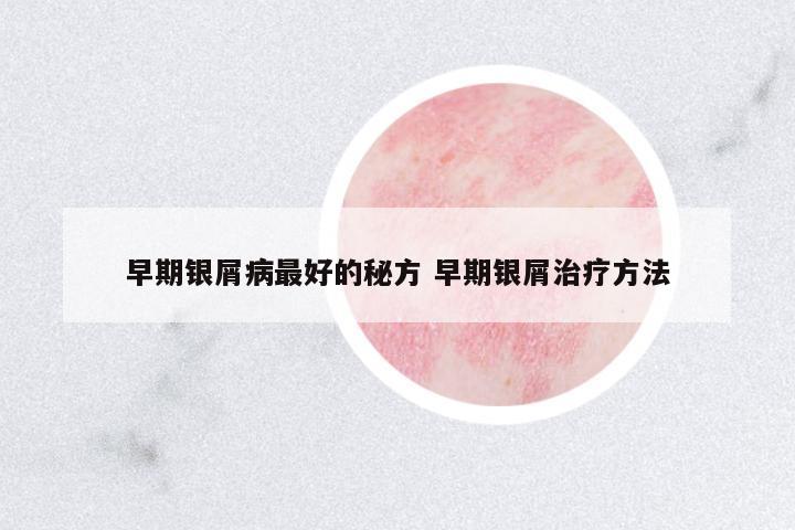 早期銀屑病最好的秘方 早期銀屑治療方法