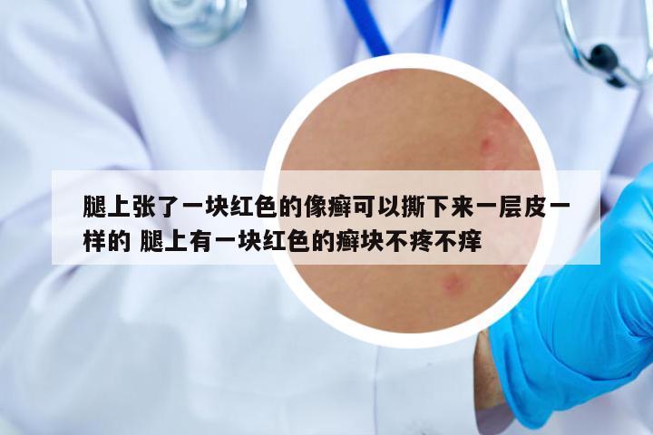 腿上張了一塊紅色的像癬可以撕下來(lái)一層皮一樣的 腿上有一塊紅色的癬塊不疼不癢