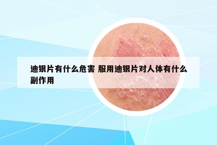 迪銀片有什么危害 服用迪銀片對(duì)人體有什么副作用