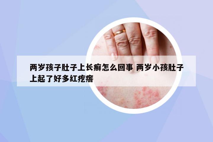 兩歲孩子肚子上長癬怎么回事 兩歲小孩肚子上起了好多紅疙瘩