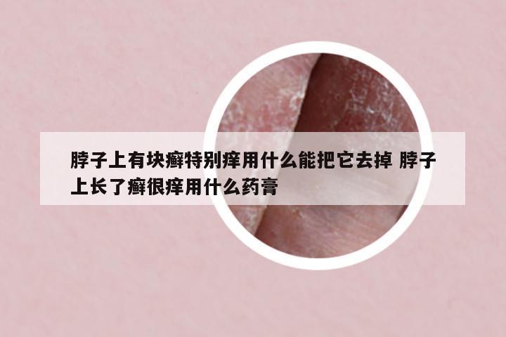 脖子上有塊癬特別癢用什么能把它去掉 脖子上長(zhǎng)了癬很癢用什么藥膏