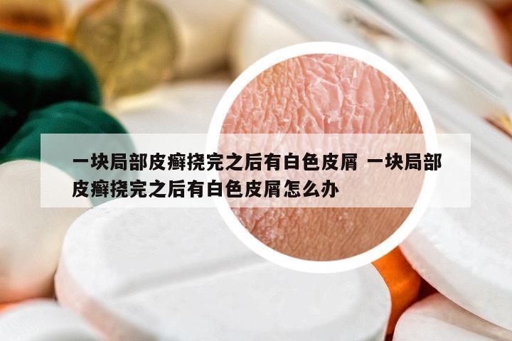 一塊局部皮癬撓完之后有白色皮屑 一塊局部皮癬撓完之后有白色皮屑怎么辦