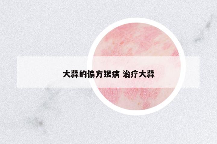 大蒜的偏方銀病 治療大蒜