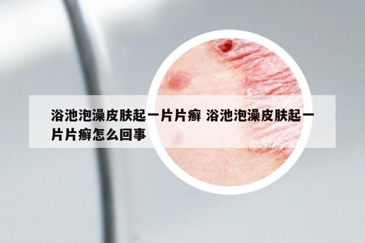 浴池泡澡皮膚起一片片癬 浴池泡澡皮膚起一片片癬怎么回事