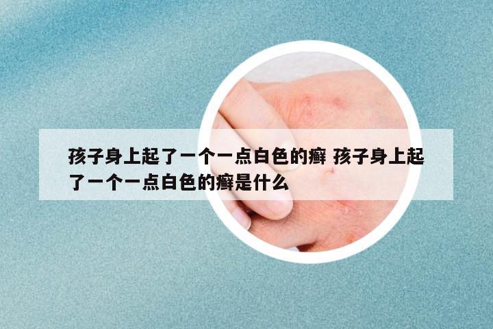孩子身上起了一個(gè)一點(diǎn)白色的癬 孩子身上起了一個(gè)一點(diǎn)白色的癬是什么