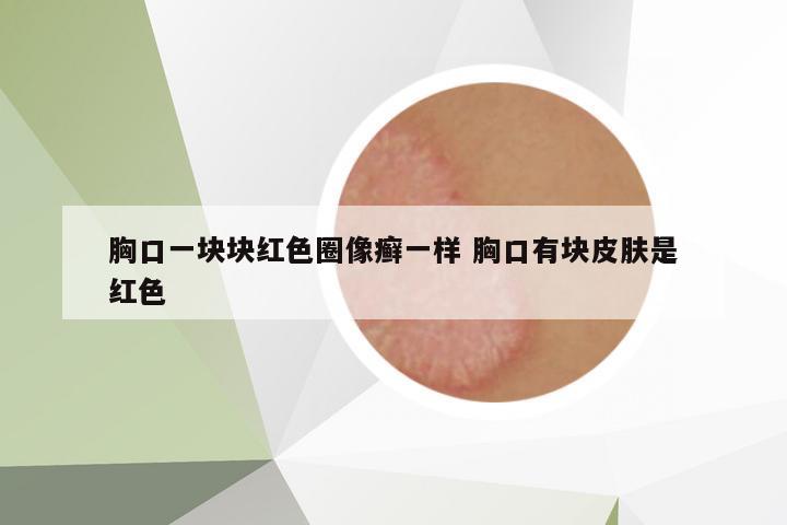 胸口一塊塊紅色圈像癬一樣 胸口有塊皮膚是紅色