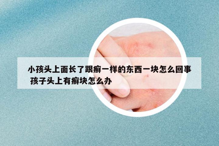 小孩頭上面長了跟癬一樣的東西一塊怎么回事 孩子頭上有癬塊怎么辦