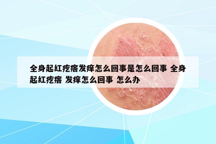 全身起紅疙瘩發(fā)癢怎么回事是怎么回事 全身起紅疙瘩 發(fā)癢怎么回事 怎么辦