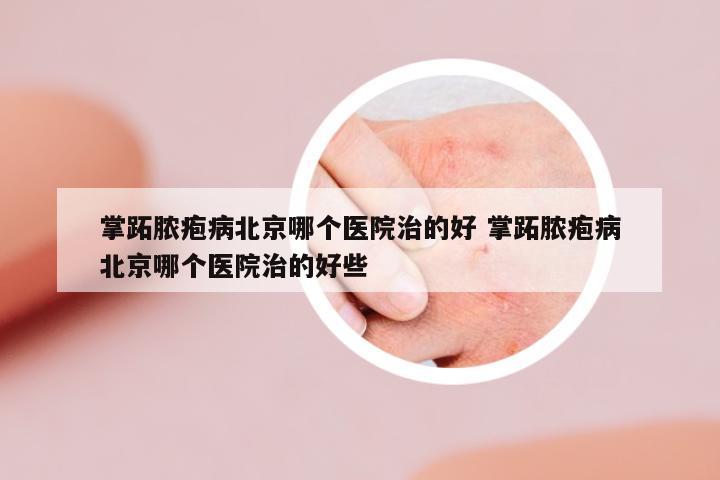掌跖膿皰病北京哪個(gè)醫(yī)院治的好 掌跖膿皰病北京哪個(gè)醫(yī)院治的好些