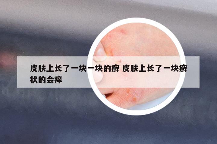 皮膚上長了一塊一塊的癬 皮膚上長了一塊癬狀的會癢
