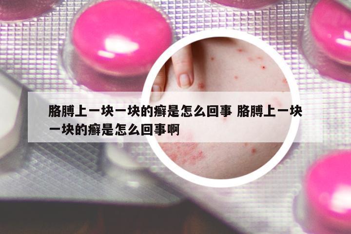 胳膊上一塊一塊的癬是怎么回事 胳膊上一塊一塊的癬是怎么回事啊