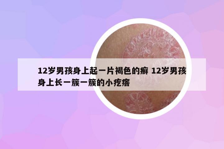 12歲男孩身上起一片褐色的癬 12歲男孩身上長(zhǎng)一簇一簇的小疙瘩