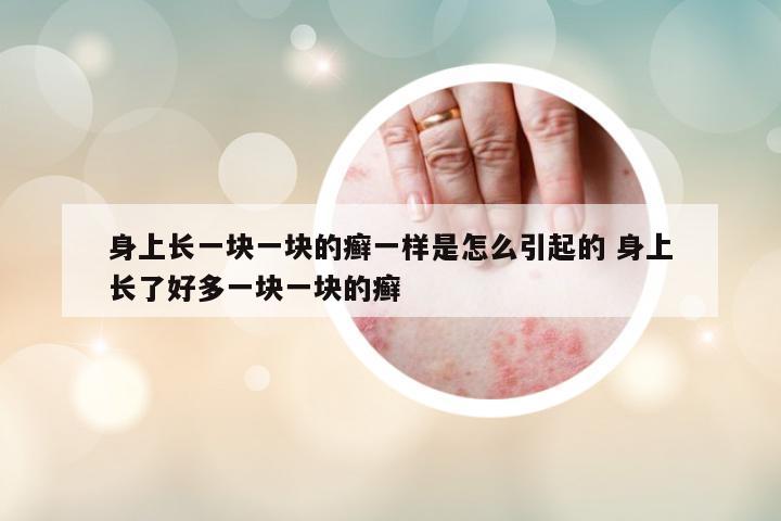 身上長一塊一塊的癬一樣是怎么引起的 身上長了好多一塊一塊的癬