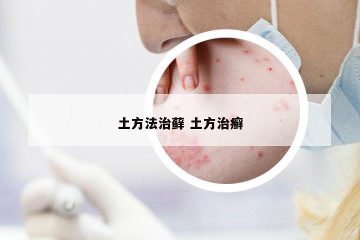 土方法治蘚 土方治癬