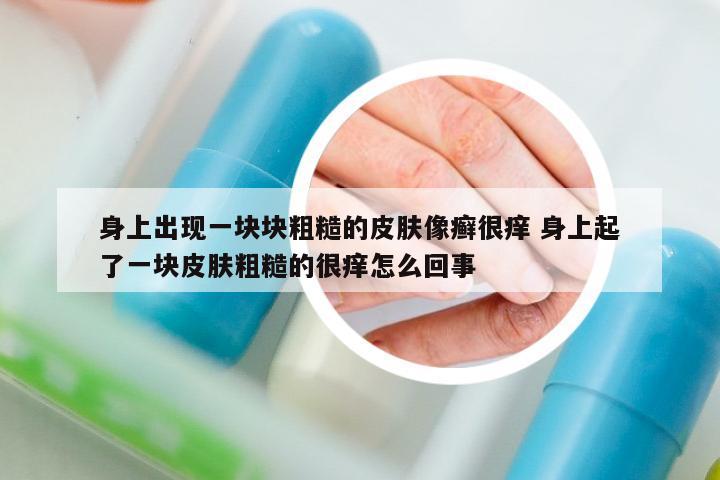 身上出現(xiàn)一塊塊粗糙的皮膚像癬很癢 身上起了一塊皮膚粗糙的很癢怎么回事
