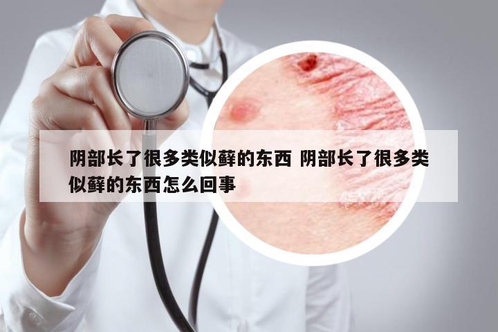 陰部長了很多類似蘚的東西 陰部長了很多類似蘚的東西怎么回事