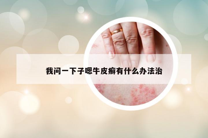 我問一下子嗯牛皮癬有什么辦法治