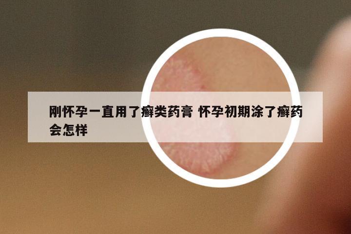 剛懷孕一直用了癬類藥膏 懷孕初期涂了癬藥會怎樣