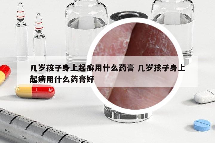 幾歲孩子身上起癬用什么藥膏 幾歲孩子身上起癬用什么藥膏好