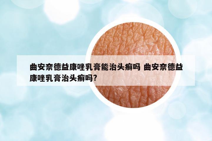 曲安奈德益康唑乳膏能治頭癬嗎 曲安奈德益康唑乳膏治頭癬嗎?