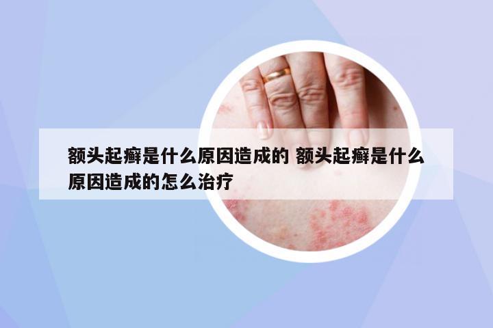 額頭起癬是什么原因造成的 額頭起癬是什么原因造成的怎么治療
