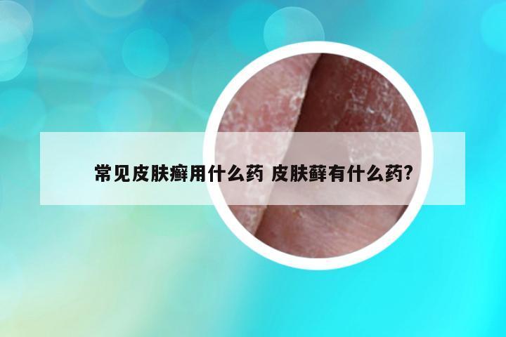 常見皮膚癬用什么藥 皮膚蘚有什么藥?