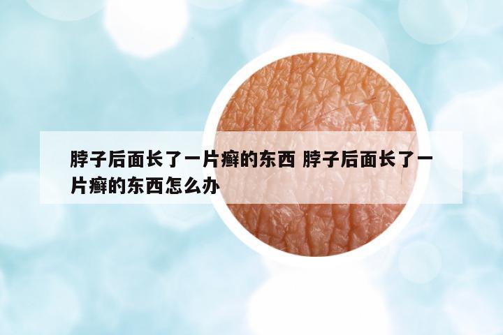 脖子后面長(zhǎng)了一片癬的東西 脖子后面長(zhǎng)了一片癬的東西怎么辦