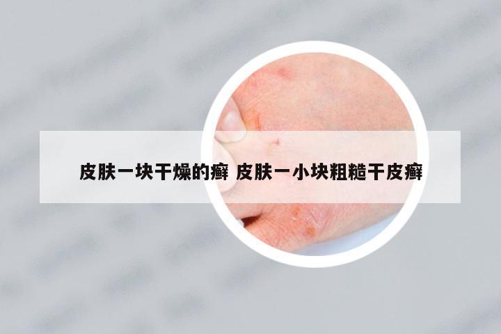 皮膚一塊干燥的癬 皮膚一小塊粗糙干皮癬