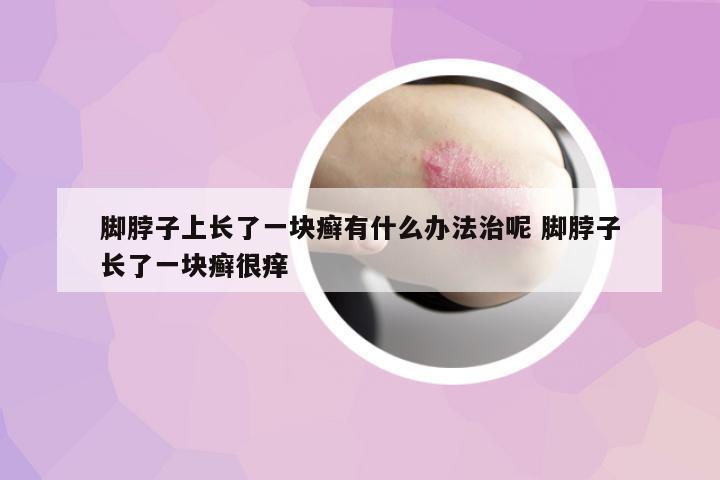腳脖子上長了一塊癬有什么辦法治呢 腳脖子長了一塊癬很癢