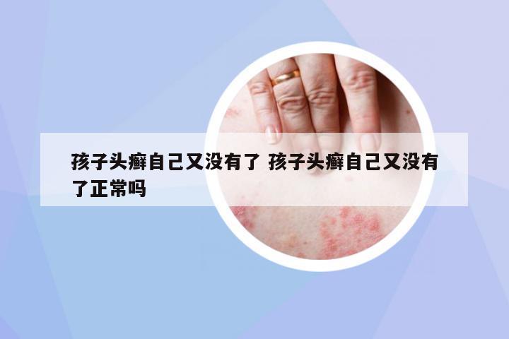 孩子頭癬自己又沒有了 孩子頭癬自己又沒有了正常嗎