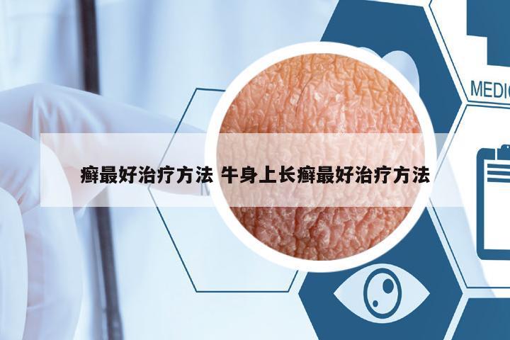 癬最好治療方法 牛身上長癬最好治療方法