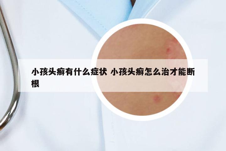 小孩頭癬有什么癥狀 小孩頭癬怎么治才能斷根