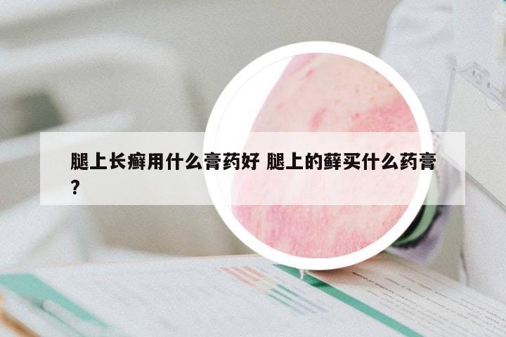 腿上長癬用什么膏藥好 腿上的蘚買什么藥膏?