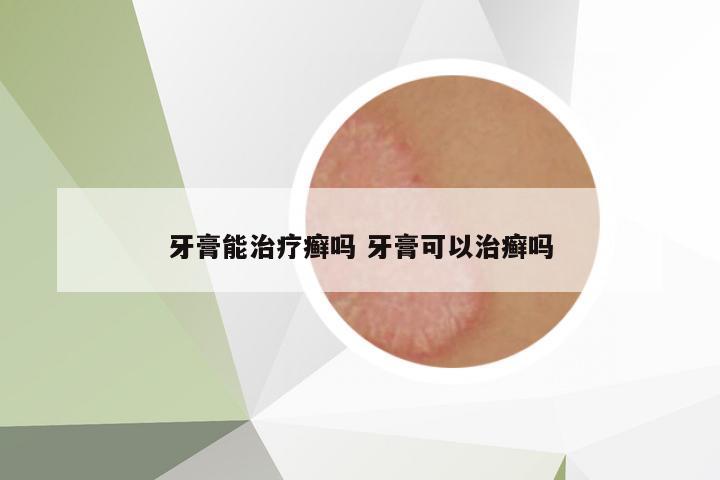牙膏能治療癬嗎 牙膏可以治癬嗎