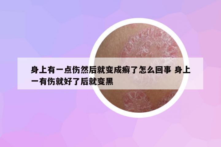 身上有一點(diǎn)傷然后就變成癬了怎么回事 身上一有傷就好了后就變黑