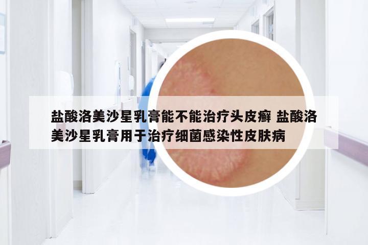 鹽酸洛美沙星乳膏能不能治療頭皮癬 鹽酸洛美沙星乳膏用于治療細(xì)菌感染性皮膚病