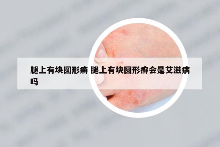 腿上有塊圓形癬 腿上有塊圓形癬會是艾滋病嗎