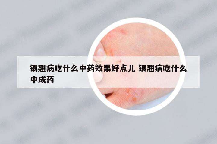 銀翹病吃什么中藥效果好點兒 銀翹病吃什么中成藥