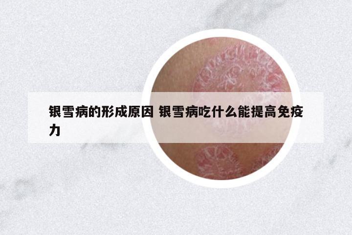銀雪病的形成原因 銀雪病吃什么能提高免疫力