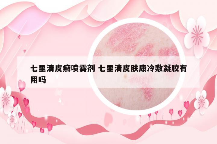 七里清皮癬噴霧劑 七里清皮膚康冷敷凝膠有用嗎