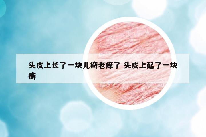 頭皮上長(zhǎng)了一塊兒癬老癢了 頭皮上起了一塊癬